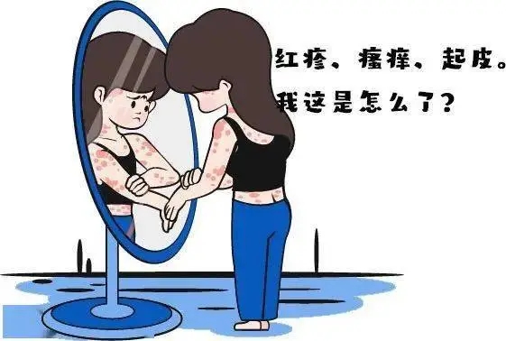 女性牛皮癣患者可以使用口红吗